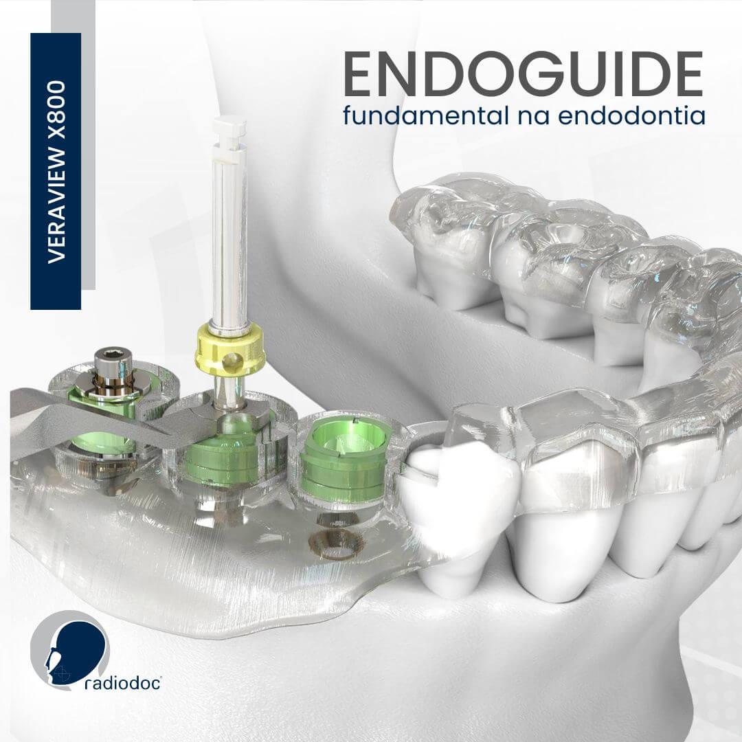 Ilustração do Endoguide