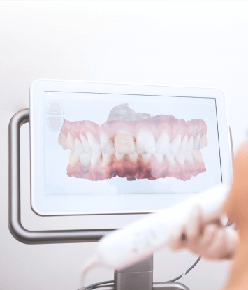 Monitor de um scanner intraoral