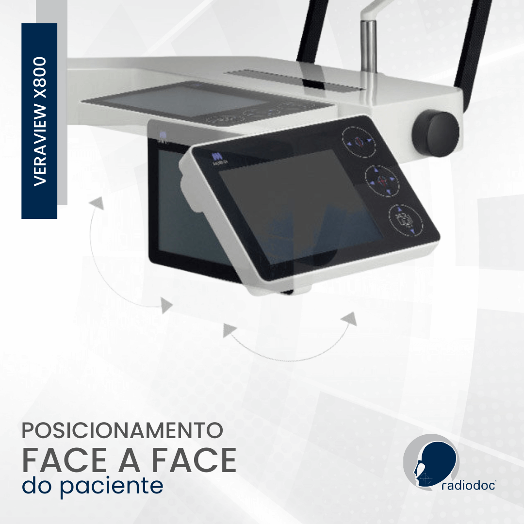 Posicionamento Face a Face do Paciente